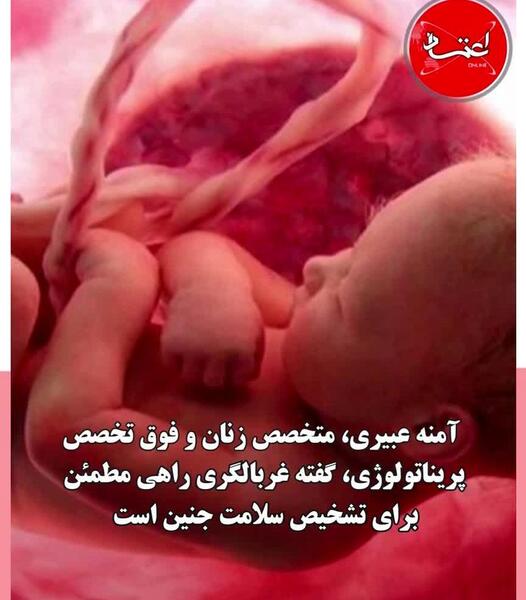 عکس جنین روزه