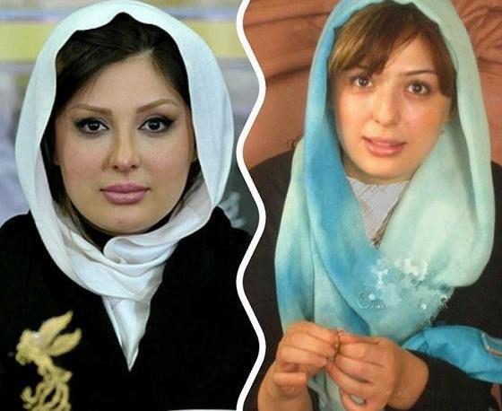 عکس چهره واقعی نیوشا ضیغمی