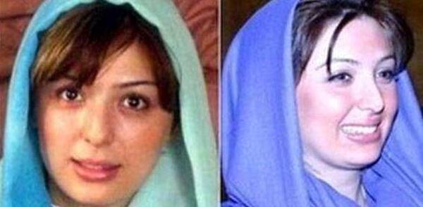 عکس نیوشا ضیغمی قبل عمل