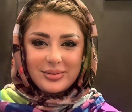 عکس نیوشا ضیغمی قبل عمل