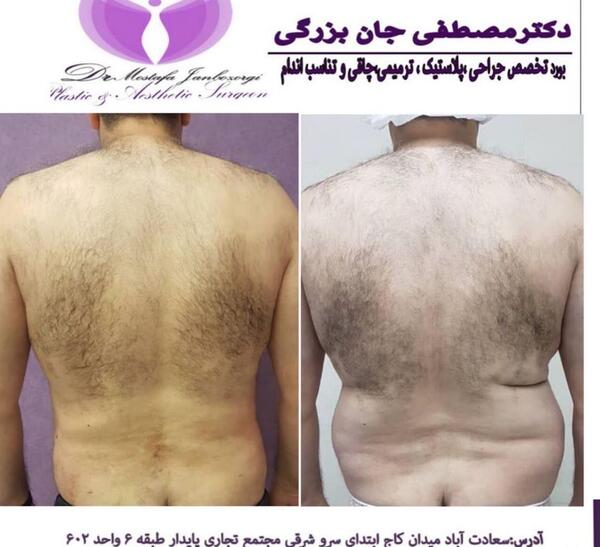 عکس زیر بغل نی نی سایت