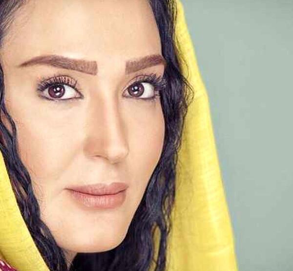 عکس زهره فکور صبور قبل عمل