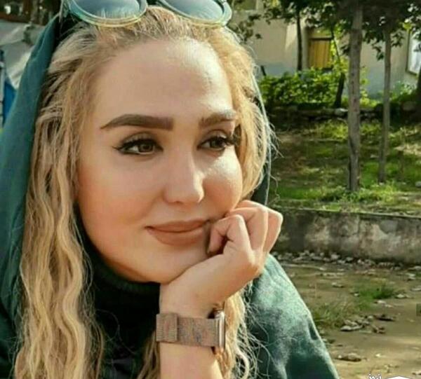 عکس زهره فکور صبور قبل عمل