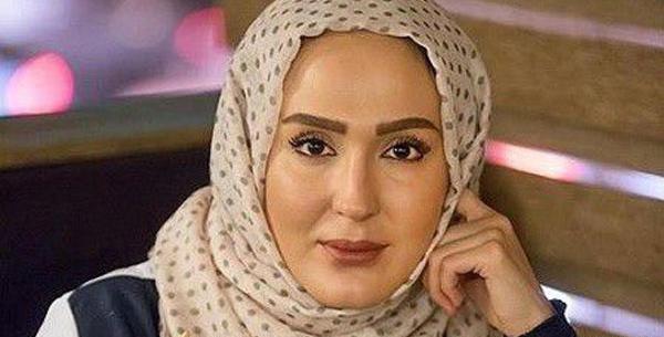 عکس زهره فکور صبور قبل عمل