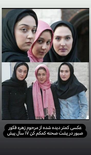 عکس زهره فکور صبور قبل عمل