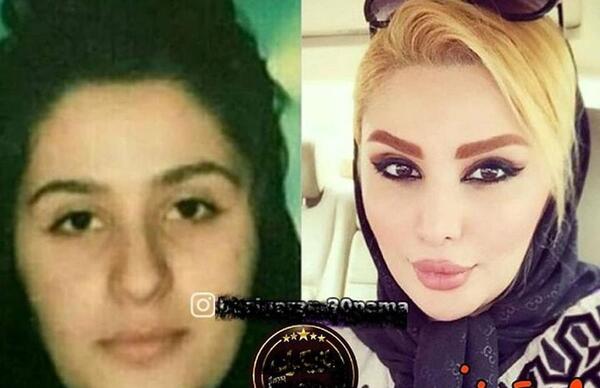 عکس های قبل عمل دنیا جهانبخت