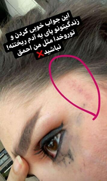 عکس های قبل عمل دنیا جهانبخت