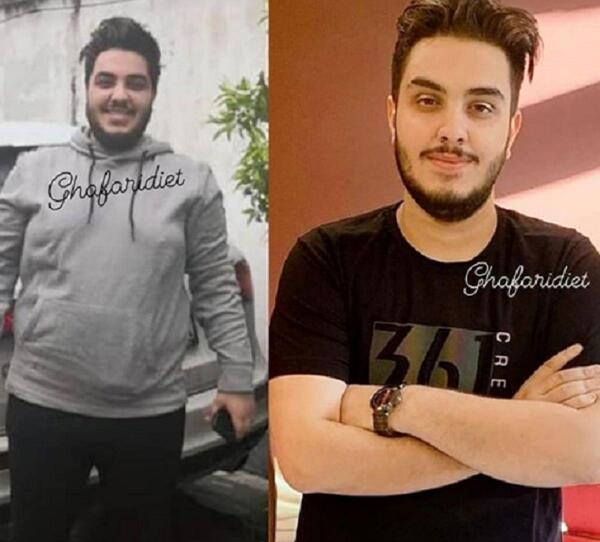 عکس ارون افشار بعد از لاغری