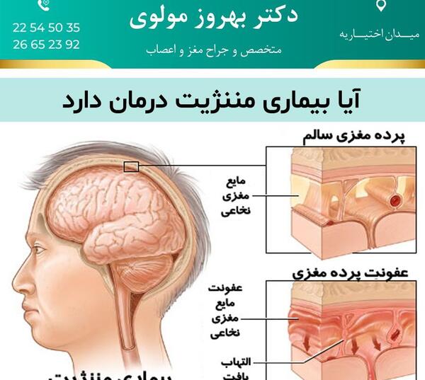 عکس های بیماری مننژیت