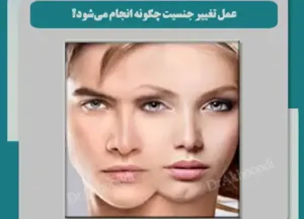 عکس ترنس ها قبل و بعد عمل