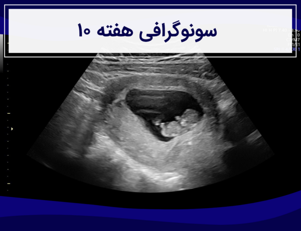 عکس جنین هفت روزه