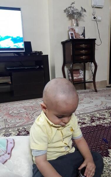 عکس پسر بچه کچل