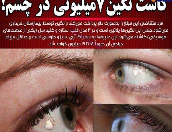 عکس نگین چشم