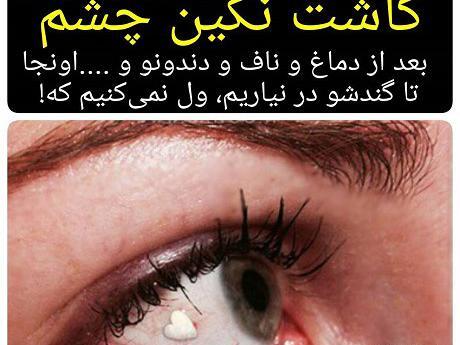 عکس نگین چشم