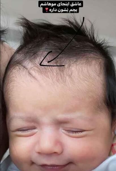عکس صورت دنیا