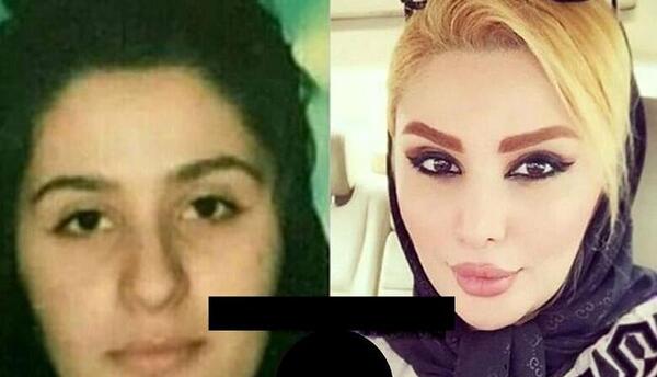 عکس صورت دنیا