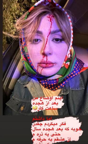 عکس نیوشا ضیغمی زشت