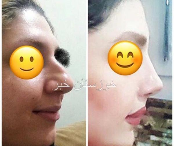 عکس قاسم زاده