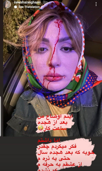 عکس تصاویر نیوشا ضیغمی در چشم باد