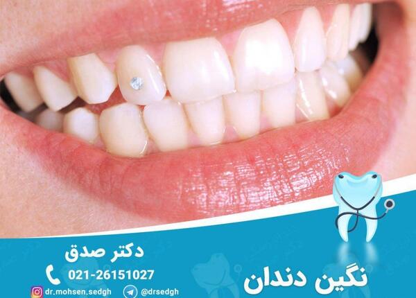 عکس نگین رو دندون