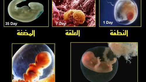 عکس چهل روزه