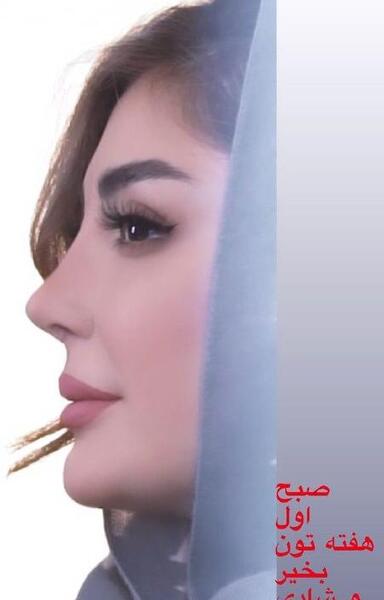 عکس نیوشا ضیغمی بعد از عمل جدیدش