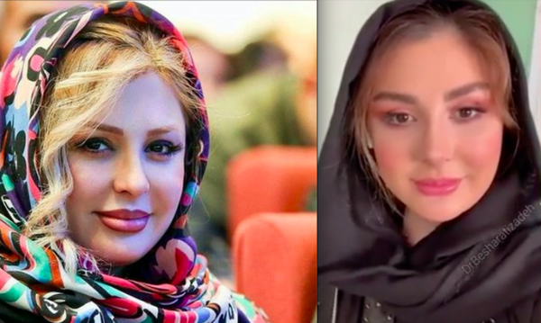 عکس نیوشا ضیغمی بعد از عمل جدیدش