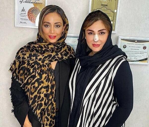 عکس نیوشا ضیغمی بعد از عمل جدیدش