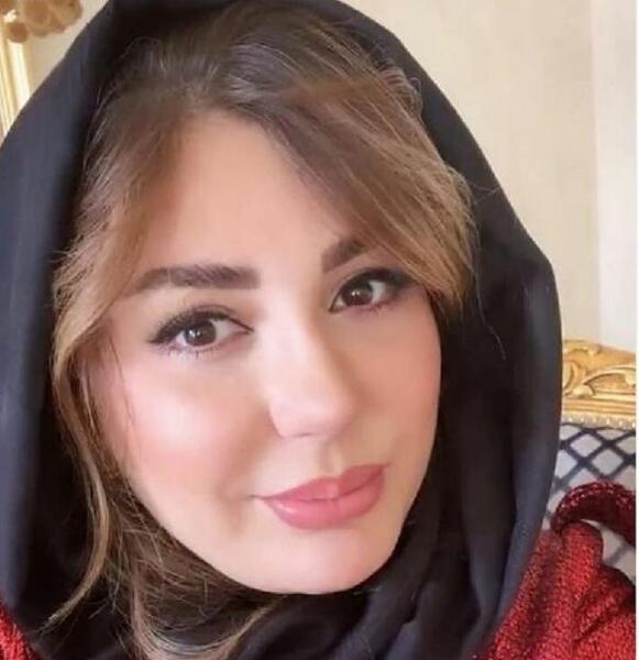 عکس نیوشا ضیغمی بعد از عمل جدیدش