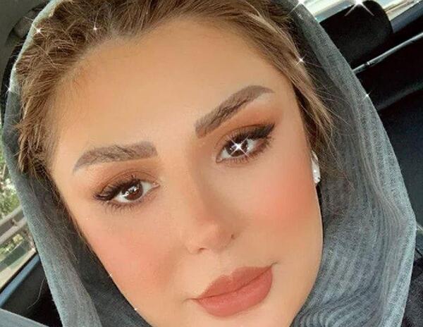 عکس نیوشا ضیغمی بعد از عمل جدیدش