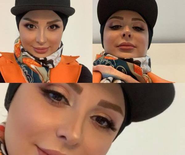 عکس صورت نیوشا ضیغمی