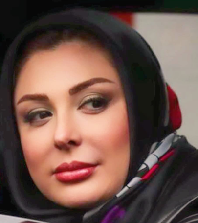عکس صورت نیوشا ضیغمی