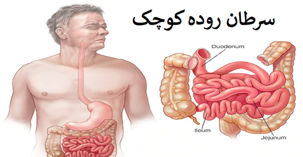 عکس روده بزرگ