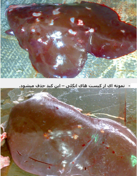 عکس جگر سفید ناسالم