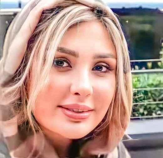 عکس نیوشا ضیغمی بعد از عمل دوم بینی
