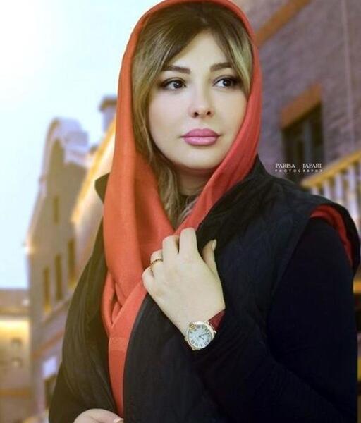 عکس نیوشا ضیغمی بعد از عمل دوم بینی