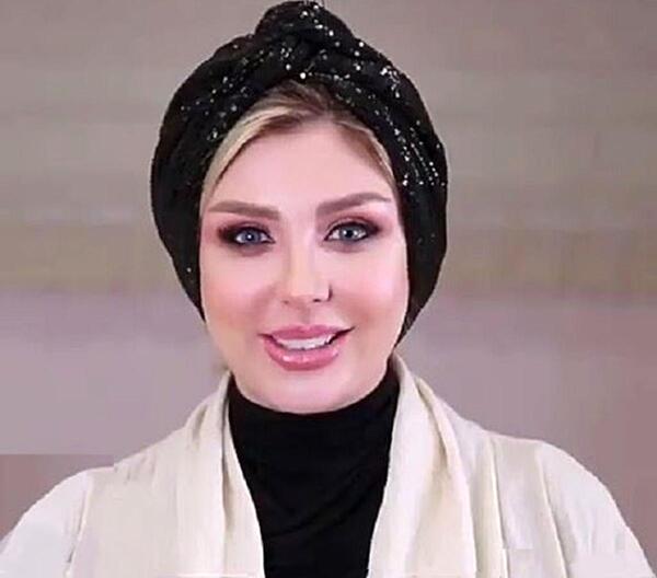 عکس نیوشا ضیغمی بعد از عمل دوم بینی