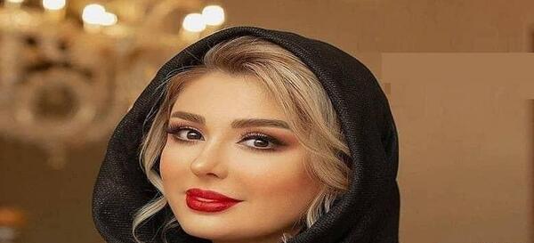 عکس نیوشا ضیغمی بعد از عمل دوم بینی
