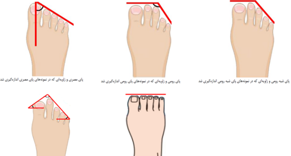 عکس سفید پا