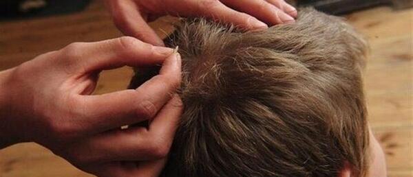 عکس کرونا در میکروسکوپ