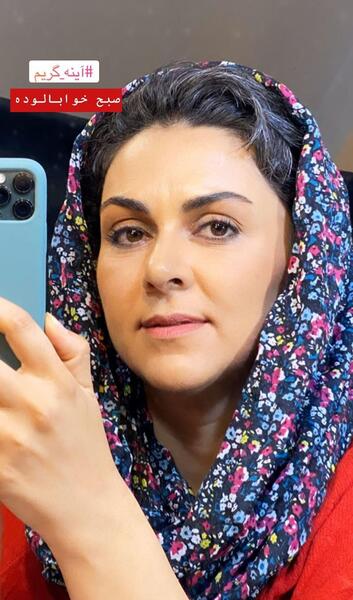 عکس صورت خواب