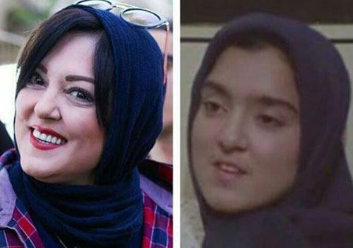عکس نگین پارسا قبل از عمل