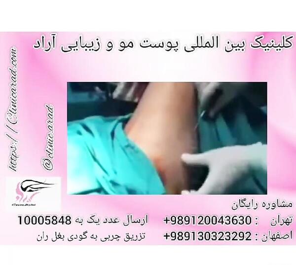 عکس تزریق چربی به بغل ران