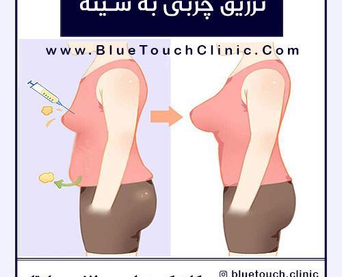 عکس تزریق چربی به بغل ران