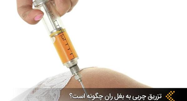 عکس تزریق چربی به بغل ران