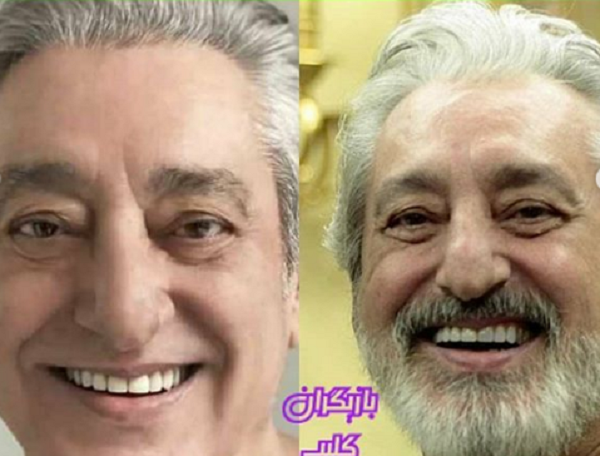 عکس ابی جدید بدون ریش