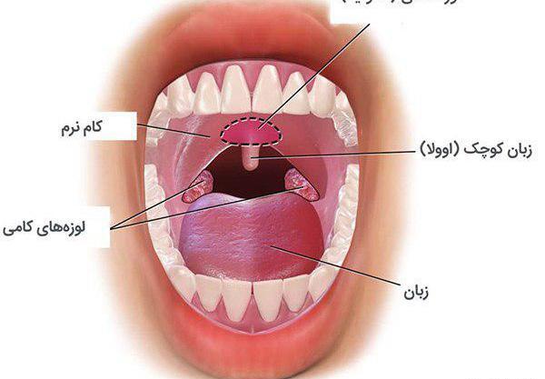 عکس لوزه کرونایی