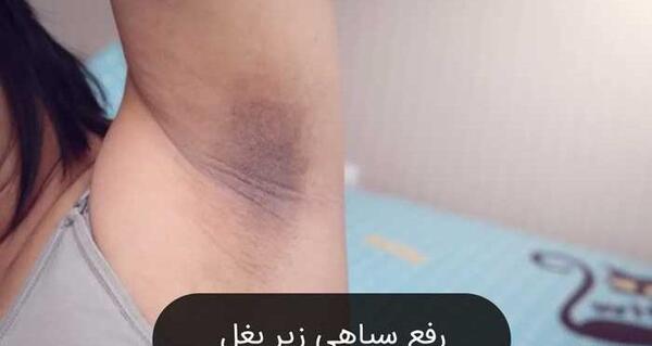عکس زیر بغل سالم