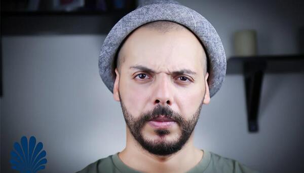 عکس کلاه پشمی بعد از کاشت مو