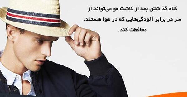 عکس کلاه پشمی بعد از کاشت مو